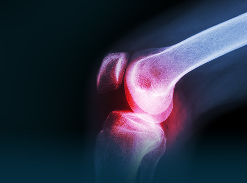 Rheumatology